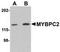Myosin Binding Protein C, Fast Type antibody, TA306943, Origene, Western Blot image 
