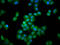 Integrator complex subunit 3 antibody, LS-C680676, Lifespan Biosciences, Immunofluorescence image 