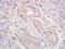 Divergent Protein Kinase Domain 2B antibody, 250490, Abbiotec, Immunohistochemistry paraffin image 