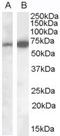 Cell Adhesion Molecule 4 antibody, TA303285, Origene, Western Blot image 