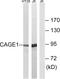 Cancer Antigen 1 antibody, GTX87737, GeneTex, Western Blot image 
