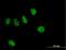 Zinc Finger Protein 484 antibody, H00083744-B01P, Novus Biologicals, Immunocytochemistry image 
