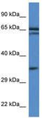 TERF2 Interacting Protein antibody, TA344832, Origene, Western Blot image 