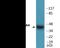 GATA Binding Protein 4 antibody, EKC2259, Boster Biological Technology, Western Blot image 