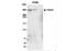 Fraser Extracellular Matrix Complex Subunit 1 antibody, NBP2-59101, Novus Biologicals, Immunoprecipitation image 