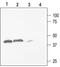 Potassium Voltage-Gated Channel Subfamily J Member 4 antibody, PA5-77595, Invitrogen Antibodies, Western Blot image 