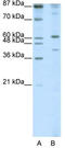 REX4 Homolog, 3'-5' Exonuclease antibody, TA345287, Origene, Western Blot image 