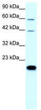 Claudin 23 antibody, TA334206, Origene, Western Blot image 
