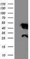 Nicotinamide N-Methyltransferase antibody, CF502624, Origene, Western Blot image 