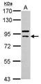Cullin 5 antibody, GTX111041, GeneTex, Western Blot image 