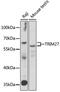 Zinc finger protein RFP antibody, GTX33559, GeneTex, Western Blot image 