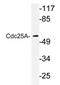 Cell Division Cycle 25A antibody, AP20356PU-N, Origene, Western Blot image 