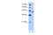 G Protein-Coupled Receptor 161 antibody, ARP42712_T100, Aviva Systems Biology, Western Blot image 