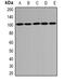 Discs Large MAGUK Scaffold Protein 4 antibody, abx225147, Abbexa, Western Blot image 