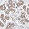Cancer Antigen 1 antibody, HPA029832, Atlas Antibodies, Immunohistochemistry frozen image 