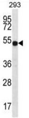 ATPase H+ Transporting V1 Subunit B1 antibody, AP50307PU-N, Origene, Western Blot image 