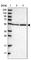Aspartyl-tRNA synthetase, cytoplasmic antibody, HPA020451, Atlas Antibodies, Western Blot image 