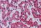 Stearoyl-CoA Desaturase antibody, MBS421254, MyBioSource, Immunohistochemistry paraffin image 
