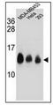 NADH:Ubiquinone Oxidoreductase Subunit C2 antibody, AP52843PU-N, Origene, Western Blot image 