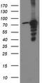 Protein Kinase C Epsilon antibody, CF502540, Origene, Western Blot image 