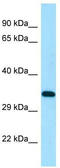 DSN1 Component Of MIS12 Kinetochore Complex antibody, TA338299, Origene, Western Blot image 