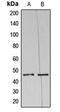 5-Azacytidine Induced 2 antibody, MBS821022, MyBioSource, Western Blot image 