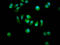 StAR Related Lipid Transfer Domain Containing 13 antibody, LS-C681475, Lifespan Biosciences, Immunofluorescence image 