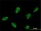 Achaete-scute homolog 1 antibody, H00000429-M02, Novus Biologicals, Immunocytochemistry image 