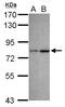 Chromodomain Y Like antibody, LS-C155509, Lifespan Biosciences, Western Blot image 