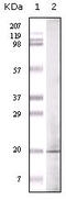 Histone-lysine N-methyltransferase EHMT1 antibody, M02433, Boster Biological Technology, Western Blot image 