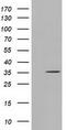 Short Chain Dehydrogenase/Reductase Family 9C Member 7 antibody, M13978-1, Boster Biological Technology, Western Blot image 