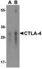 CD152 antibody, TA355058, Origene, Western Blot image 