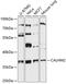 Calcium Homeostasis Modulator Family Member 2 antibody, 14-742, ProSci, Western Blot image 