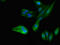 Myosin VIIA And Rab Interacting Protein antibody, orb53667, Biorbyt, Immunocytochemistry image 