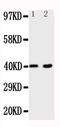 Baculoviral IAP Repeat Containing 7 antibody, PA1427, Boster Biological Technology, Western Blot image 