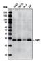 Sirtuin 3 antibody, LS-C75838, Lifespan Biosciences, Western Blot image 