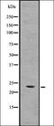 CASP2 And RIPK1 Domain Containing Adaptor With Death Domain antibody, orb336757, Biorbyt, Western Blot image 