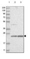 ERI1 Exoribonuclease Family Member 3 antibody, HPA029895, Atlas Antibodies, Western Blot image 