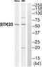 Serine/Threonine Kinase 33 antibody, TA312422, Origene, Western Blot image 