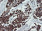 Mitochondrial Ribosomal Protein S27 antibody, LS-C175202, Lifespan Biosciences, Immunohistochemistry paraffin image 