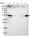 Zinc Finger FYVE-Type Containing 27 antibody, NBP1-83512, Novus Biologicals, Western Blot image 