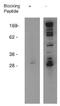 Sphingosine Kinase 1 antibody, orb109017, Biorbyt, Western Blot image 