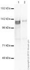 Zinc Finger Protein 281 antibody, ab101318, Abcam, Western Blot image 