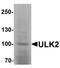 Unc-51 Like Autophagy Activating Kinase 2 antibody, TA319785, Origene, Western Blot image 