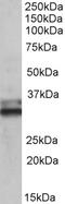 Secreted Frizzled Related Protein 1 antibody, 42-478, ProSci, Immunohistochemistry paraffin image 