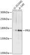 Periaxin antibody, 18-084, ProSci, Western Blot image 