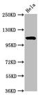 N-Acetyltransferase 10 antibody, LS-C675075, Lifespan Biosciences, Western Blot image 