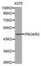 Prokineticin receptor 2 antibody, PA5-76785, Invitrogen Antibodies, Western Blot image 