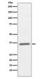 Collagen Type II Alpha 1 Chain antibody, M00517, Boster Biological Technology, Western Blot image 