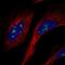 NOP53 Ribosome Biogenesis Factor antibody, PA5-65569, Invitrogen Antibodies, Immunofluorescence image 